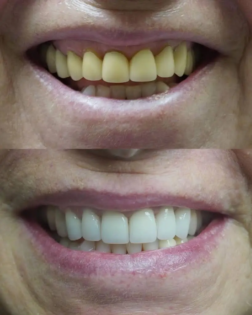 Sunrise Smiles Dentistry