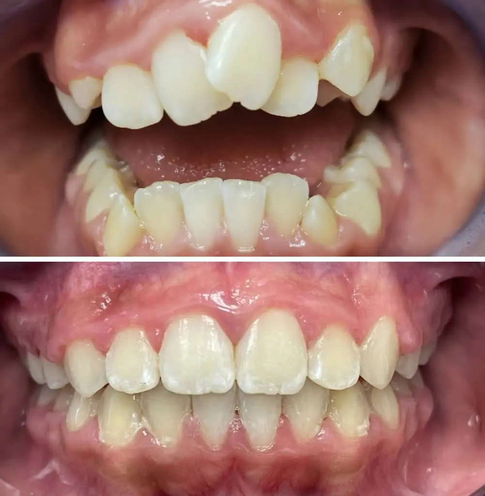Sunrise Smiles Dentistry