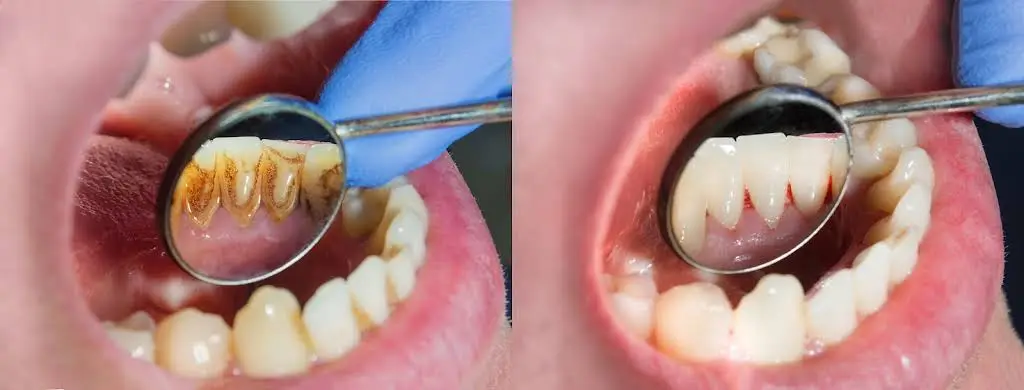SGI Dentistry