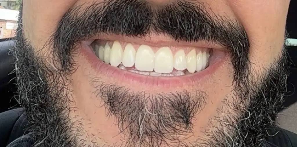 Smiland Dental Fort Lauderdale