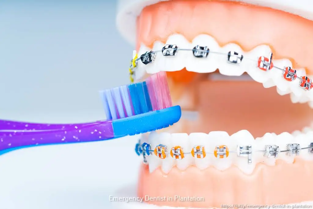 Smile Design Dental of Plantation