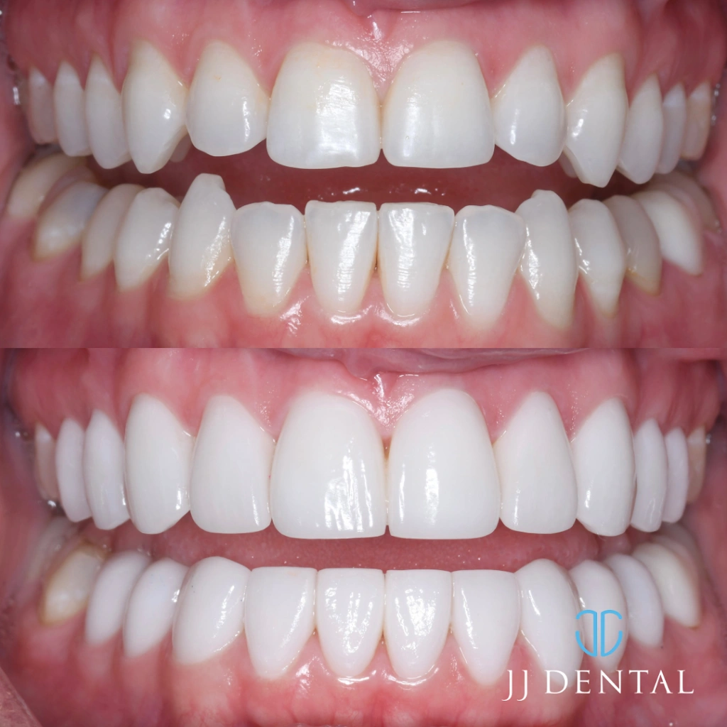 JJ Dental