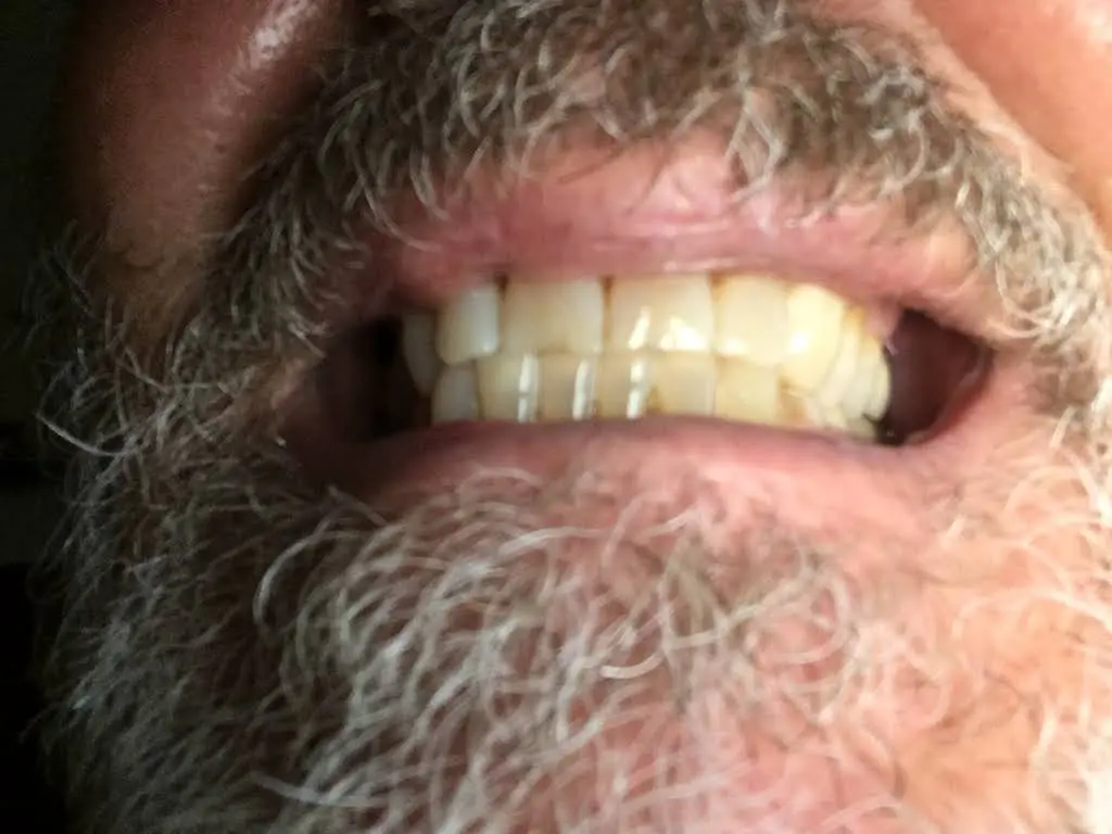 LLERA Dental