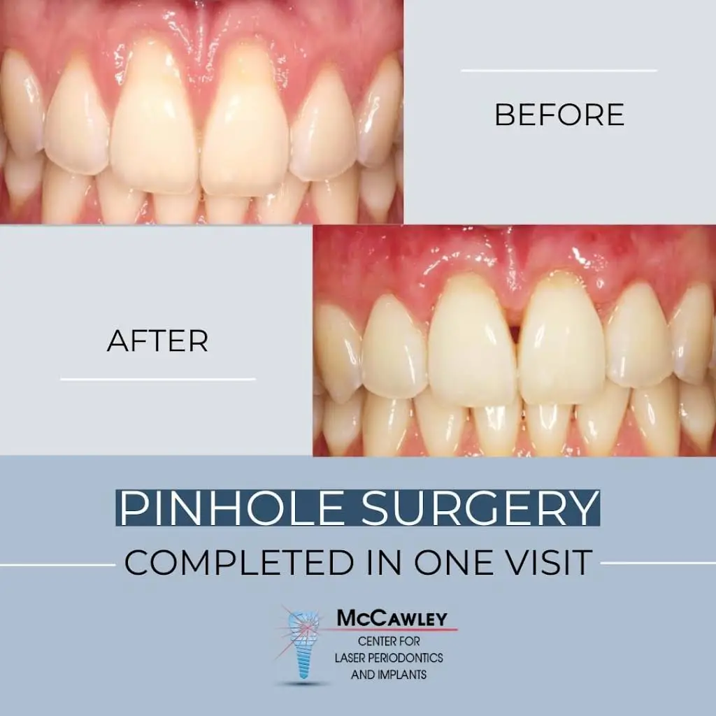 McCawley Center for Laser Periodontics & Implants