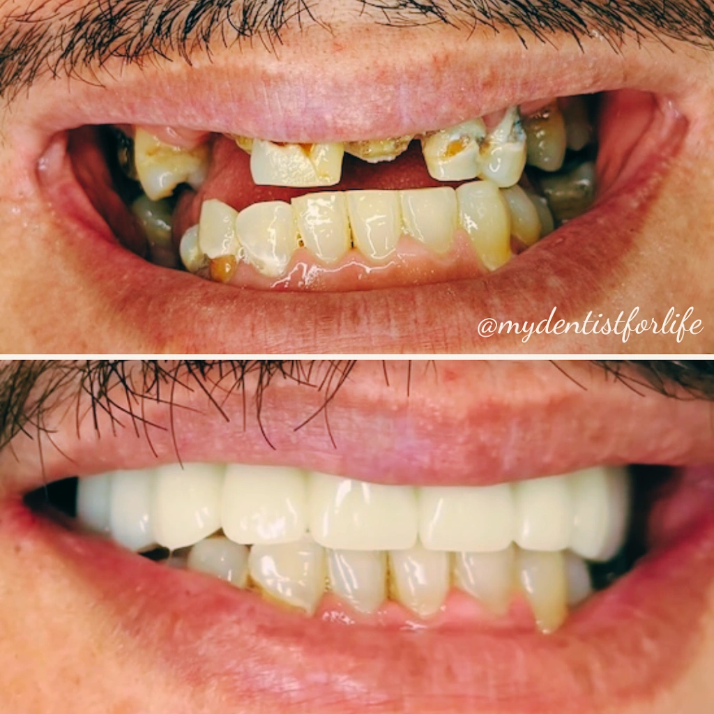 My Dentist For Life of Plantation
