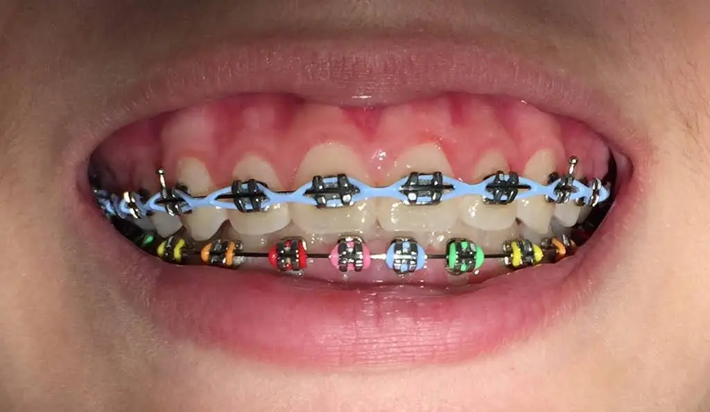 Cooper Orthodontics