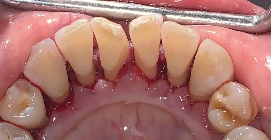 Raul Cook, DDS, MSD Periodontics & Dental Implants