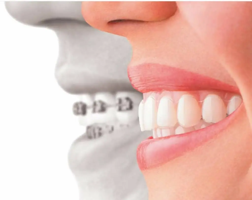 Comfort Dentists of Plantation