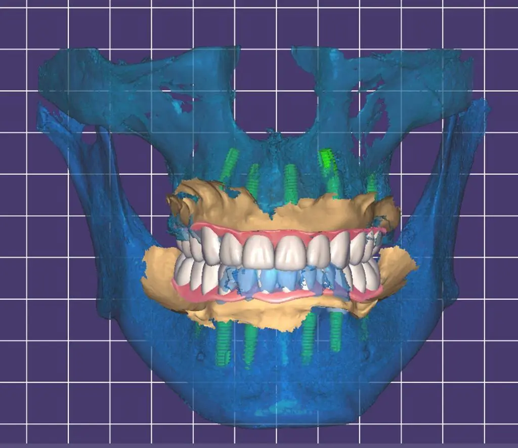 Miracle Smile Dentistry