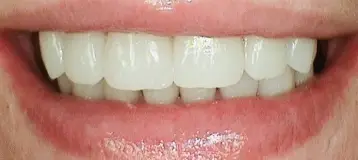Cuartas Advanced Dentistry
