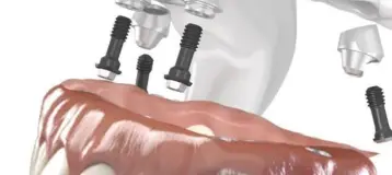 Sunrise Dentist PA