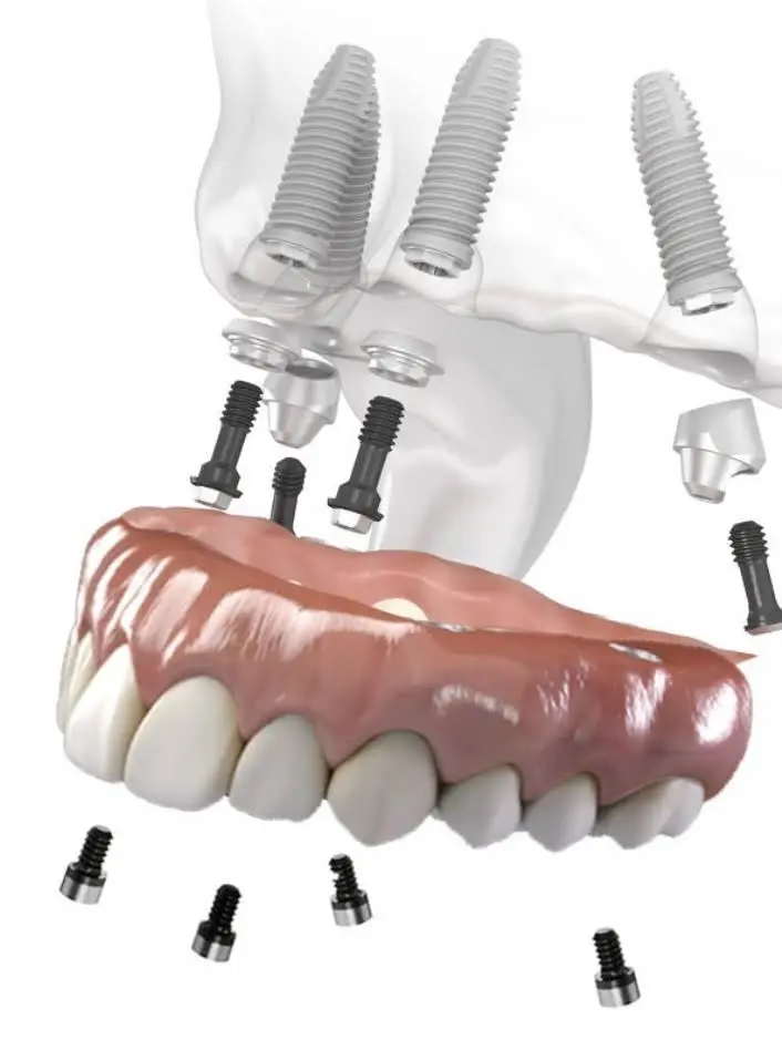 Sunrise Dentist PA - Professional dental clinic exterior with modern facilities