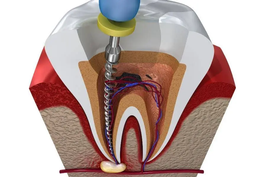 Artisa Dental