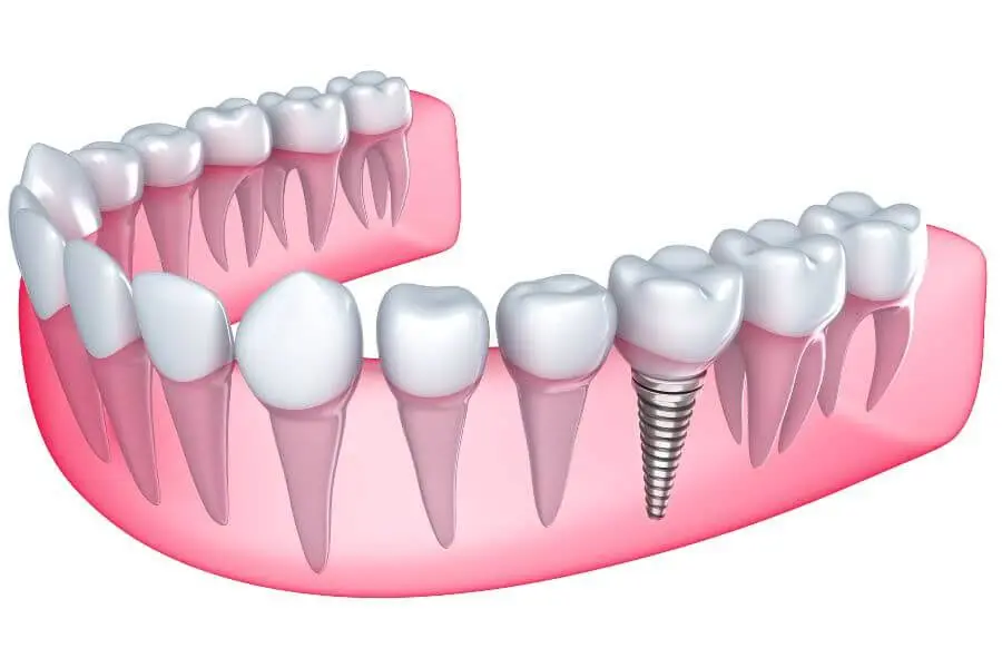 Artisa Dental