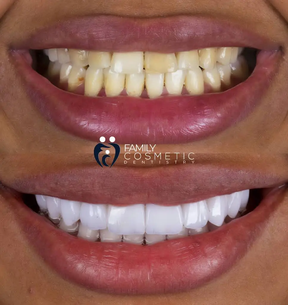 Family Cosmetic Dentistry - Weston Dentist