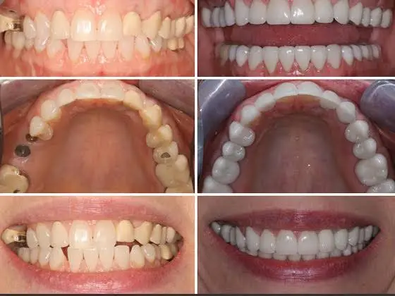 Preferred Dental Care