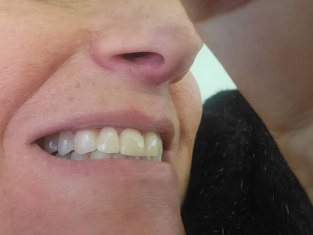 Preferred Dental Care
