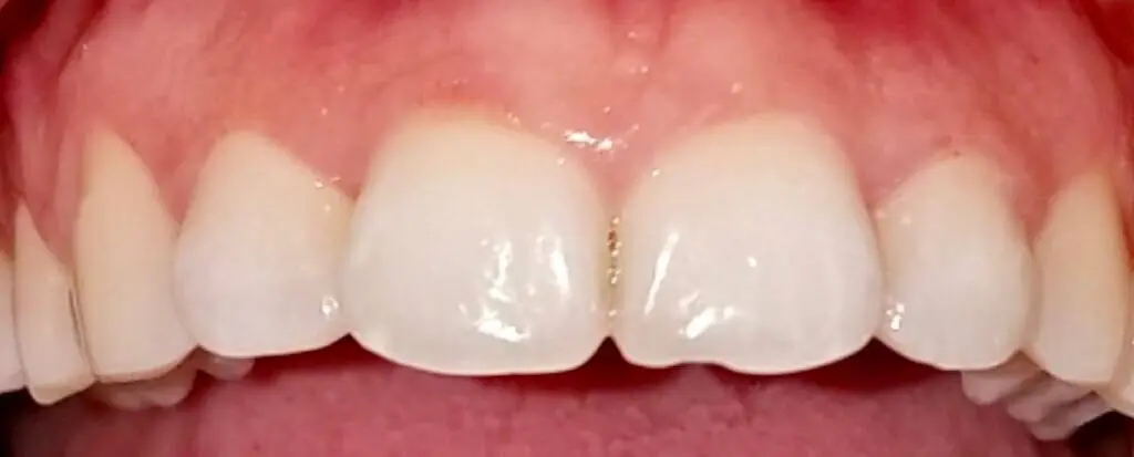 Gentle Teeth & Braces