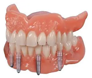 Kocher & Kocher Dentistry PA
