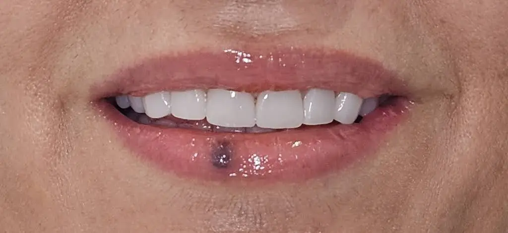 Jonari Dental of Cooper City