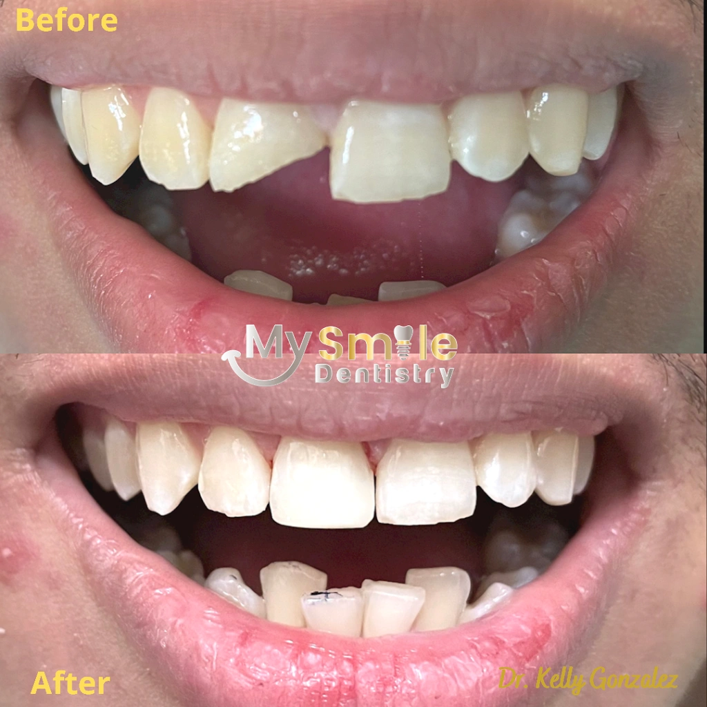 My Smile Dentistry: Kelly Gonzalez, DMD