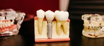 Innovation Dental Center