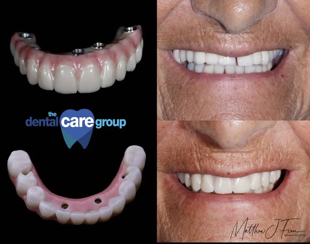 The Dental Care Group