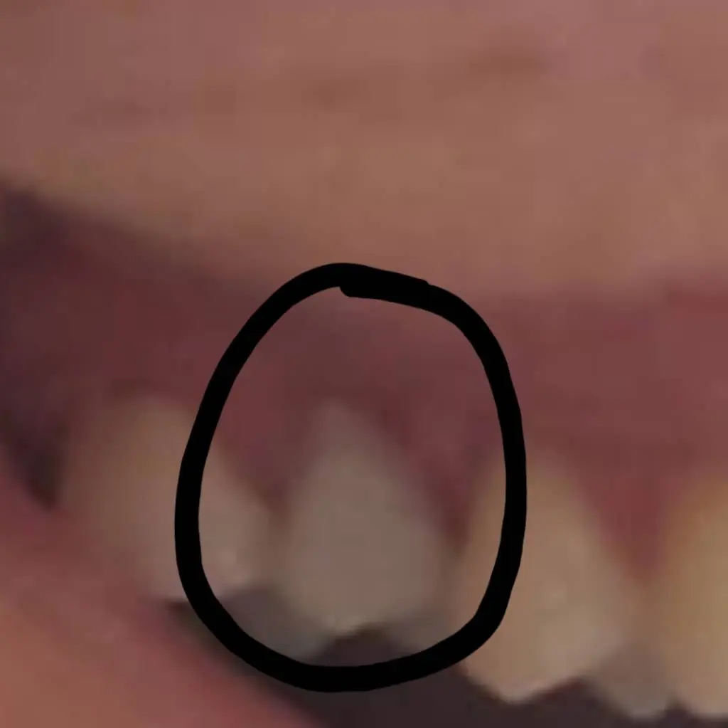 Hollywood Perfect Smile
