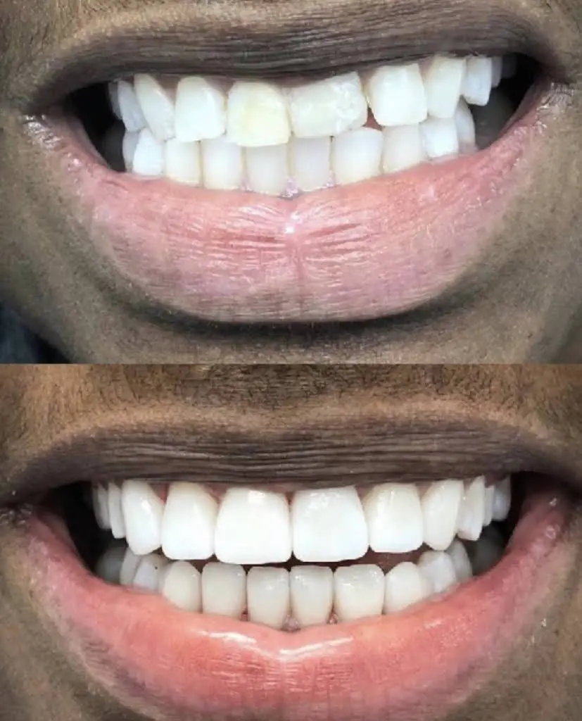 Pembroke Pines Dental