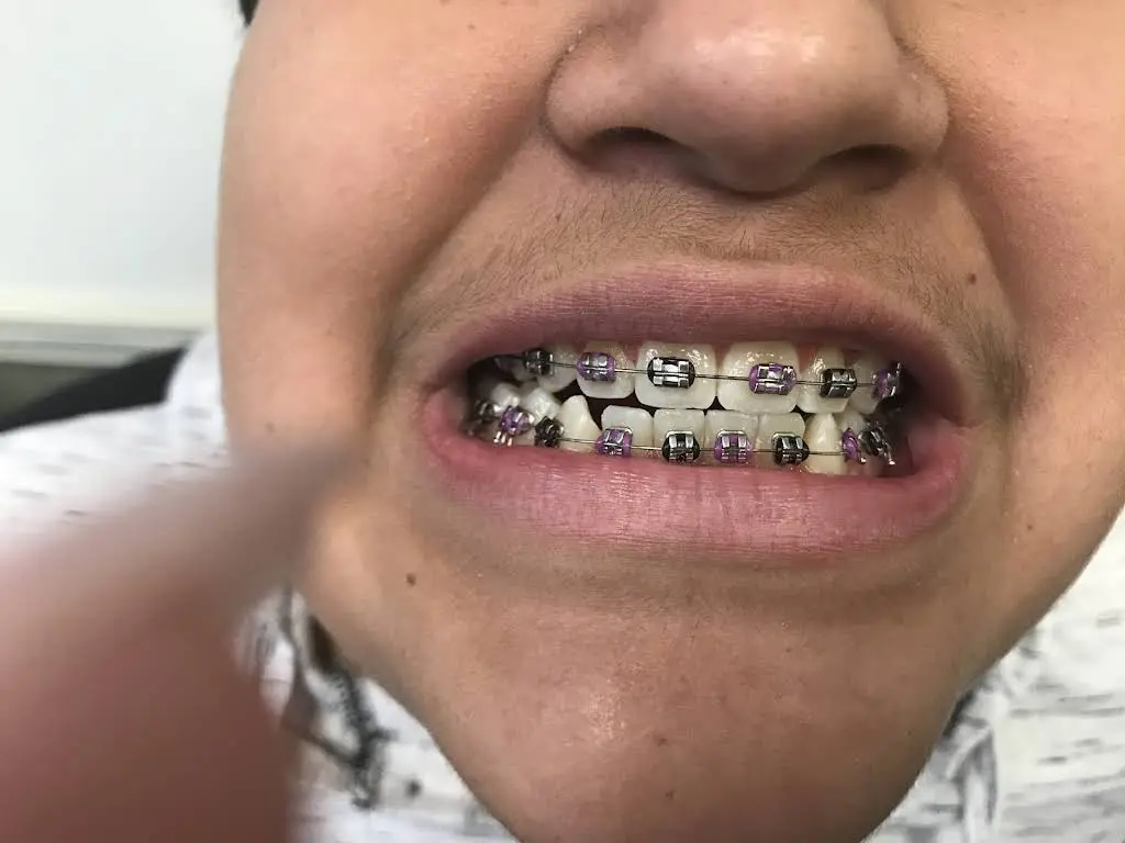 Great Expressions Dental Centers