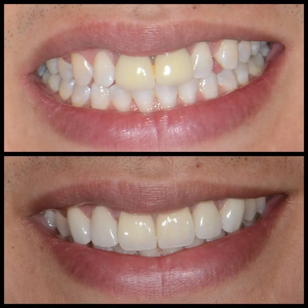 EN Smile Design: Eric H. Naierman, DDS