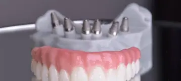 Upper Dental Hollywood