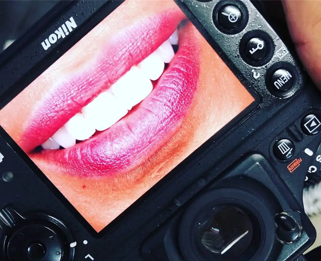 Upper Dental Hollywood