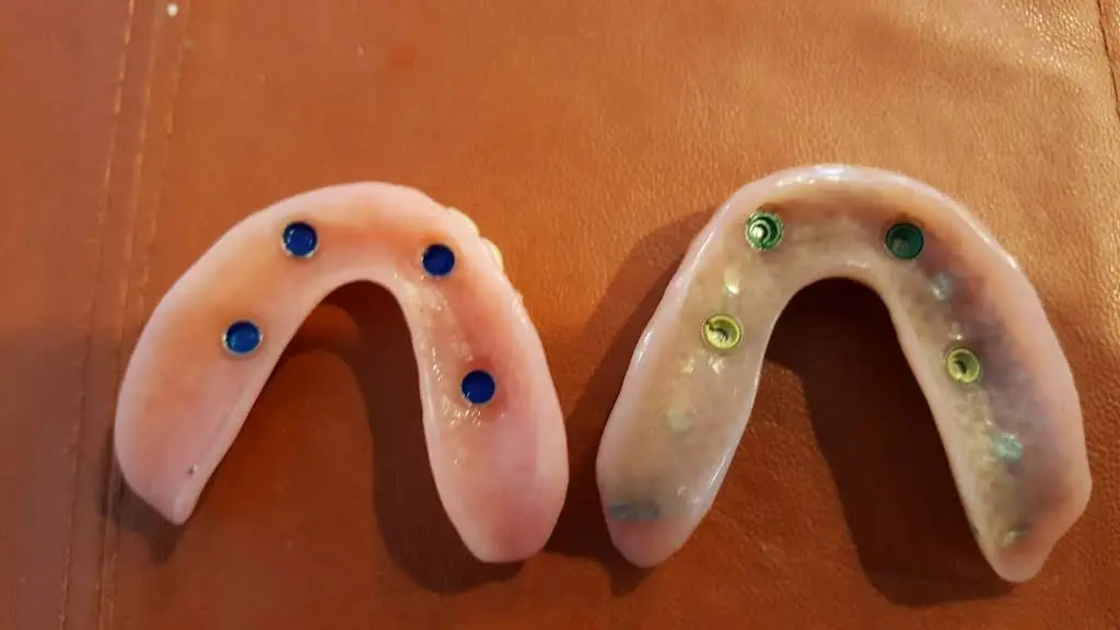 Malo Dental Prosthodontics