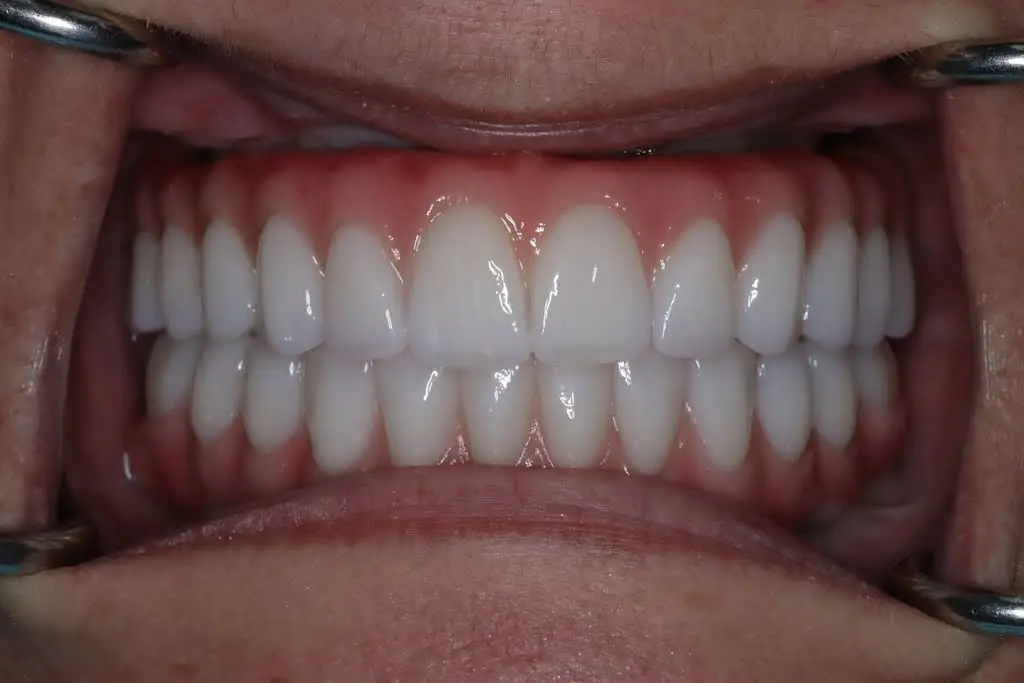 Malo Dental Prosthodontics