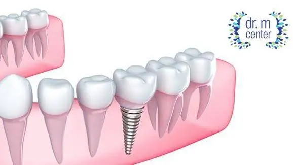 Dr. M Center / Francisco Montamarta DDS