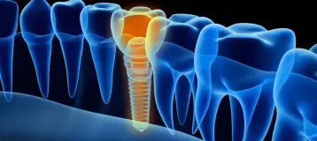 Bluewave Dentistry