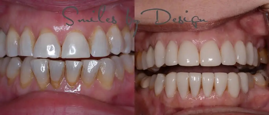 Smiles by Design, Inc.