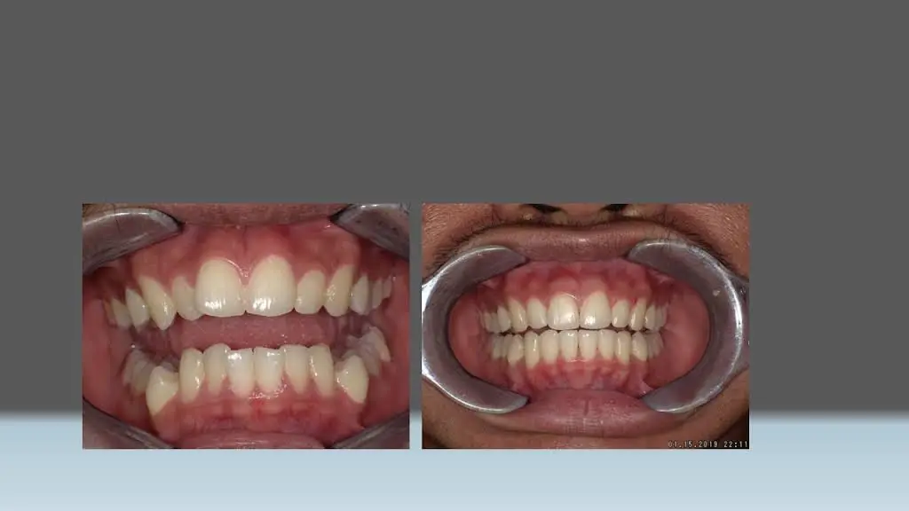 Dental Care Center of Hollywood