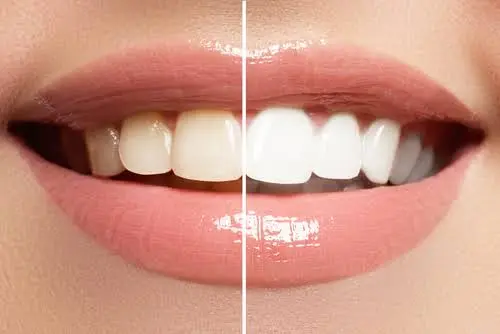 Sweet Hart Dental