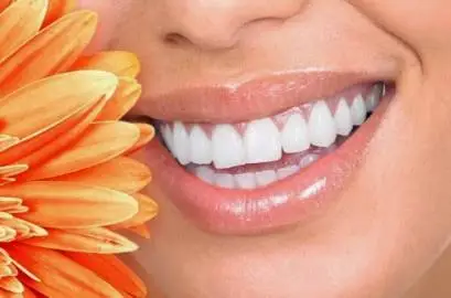 Great Hollywood Smiles - Dr David Peretz
