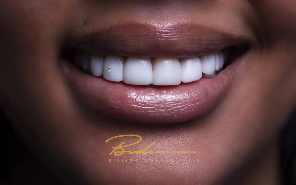 Billion Dollar Smile - Elite Smile Makeovers