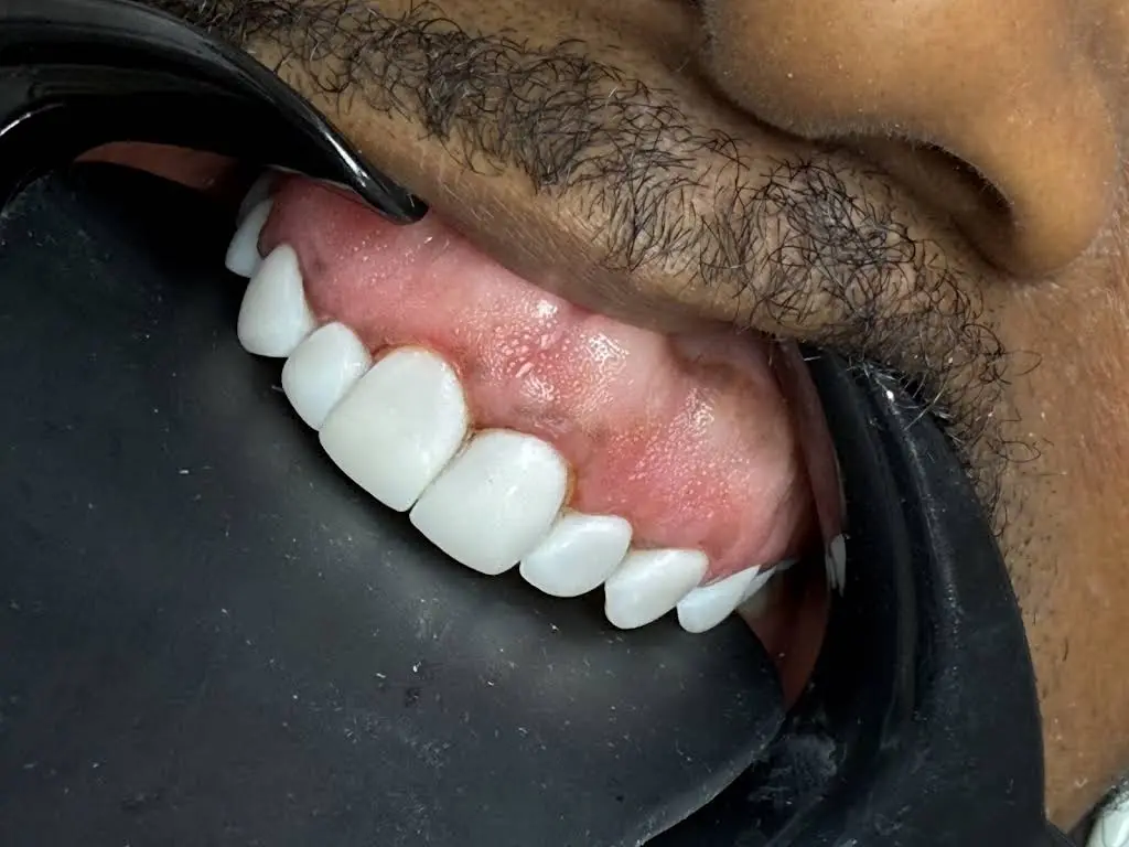 Billion Dollar Smile - Elite Smile Makeovers
