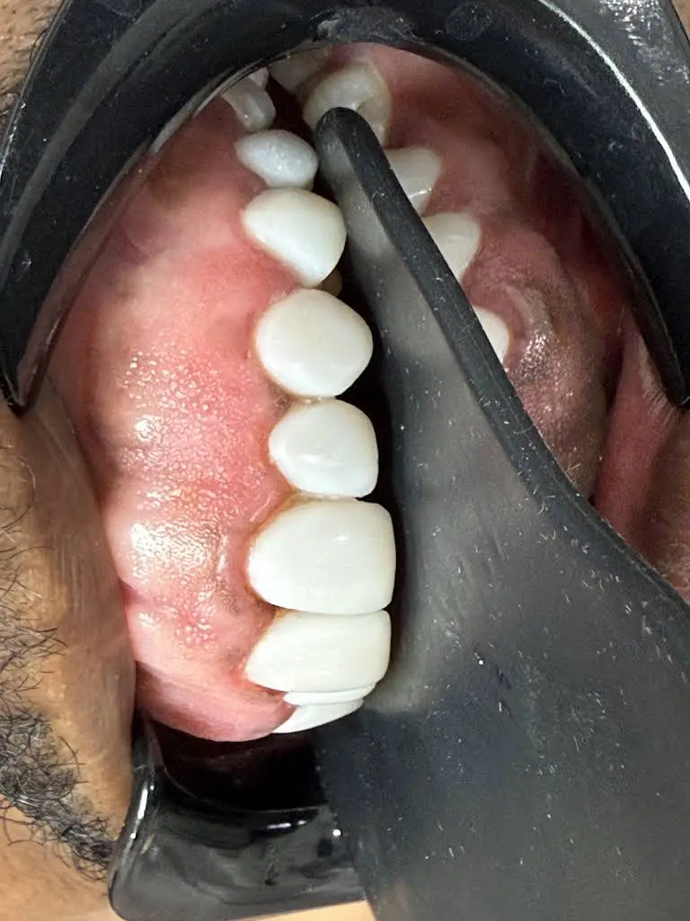 Billion Dollar Smile - Elite Smile Makeovers