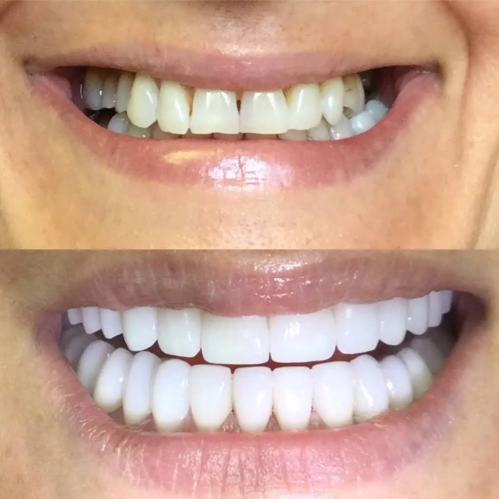 Svetlana Dental & Esthetic Center