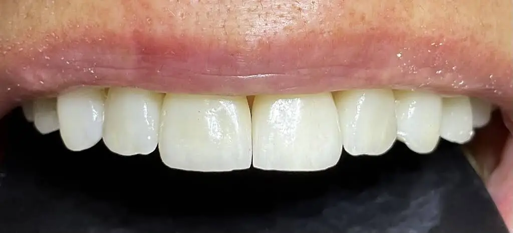 Svetlana Dental & Esthetic Center