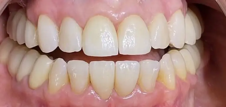 Svetlana Dental & Esthetic Center