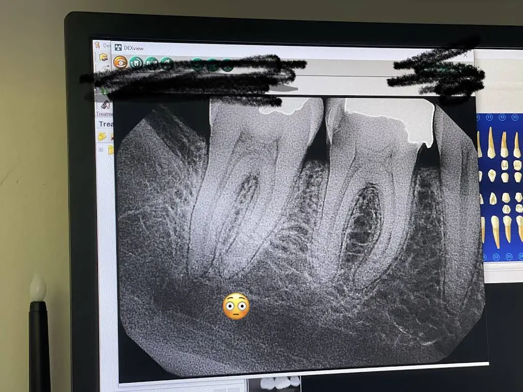 Aspen Dental