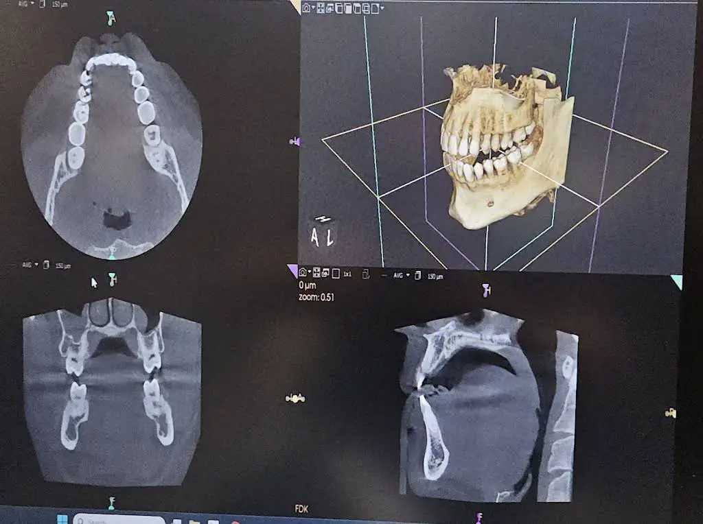 Aspen Dental