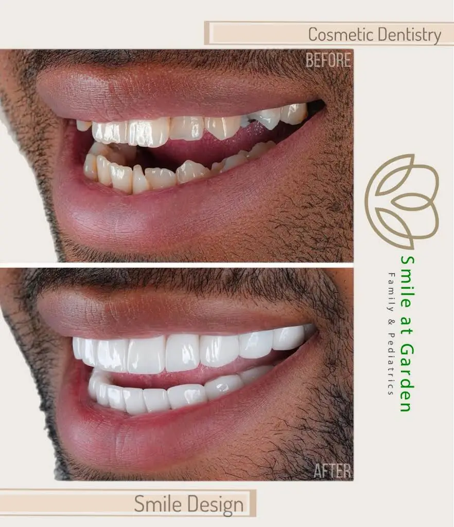 Smile at Gardens